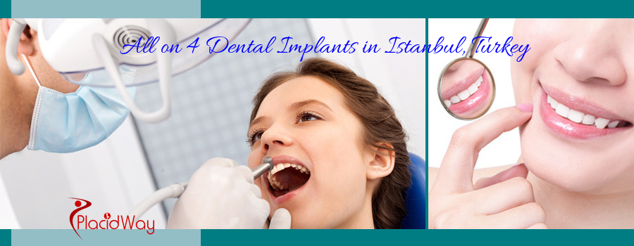 All on 4 Dental Implants in Istanbul, Turkey